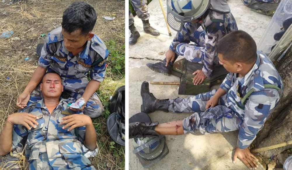 मोतीपुर घटनामा घाइते भएका ४ सुरक्षाकर्मीलाई  उपचारका लागि काठमाडौं ल्याइयो 