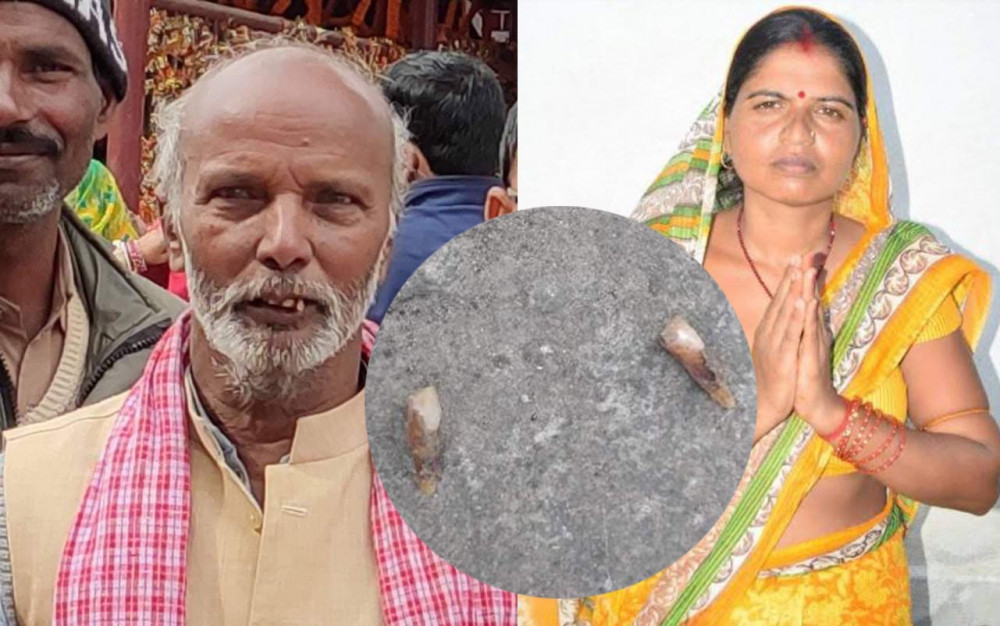 उपाध्यक्षले भाँचे अध्यक्षको दाँत